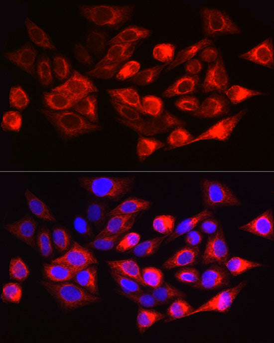 Cytokeratin 17 (KRT17) Rabbit pAb