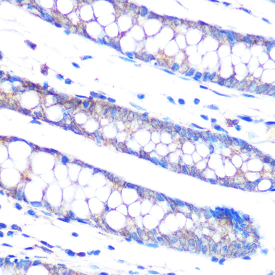 DUSP6 Rabbit mAb