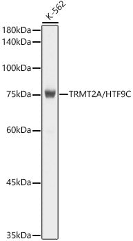 TRMT2A/HTF9C Rabbit mAb