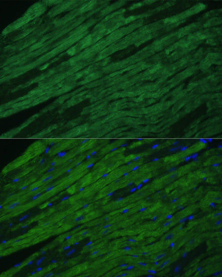 Cardiac Troponin I (TNNI3) Rabbit pAb
