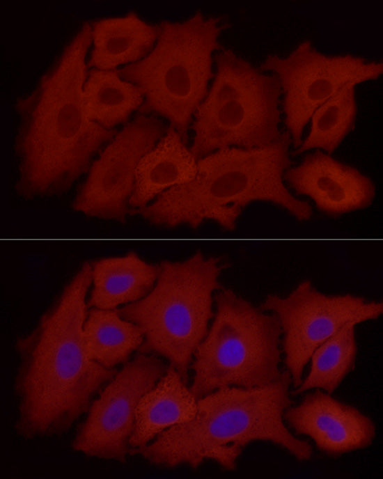 ALDH1A1 Rabbit mAb