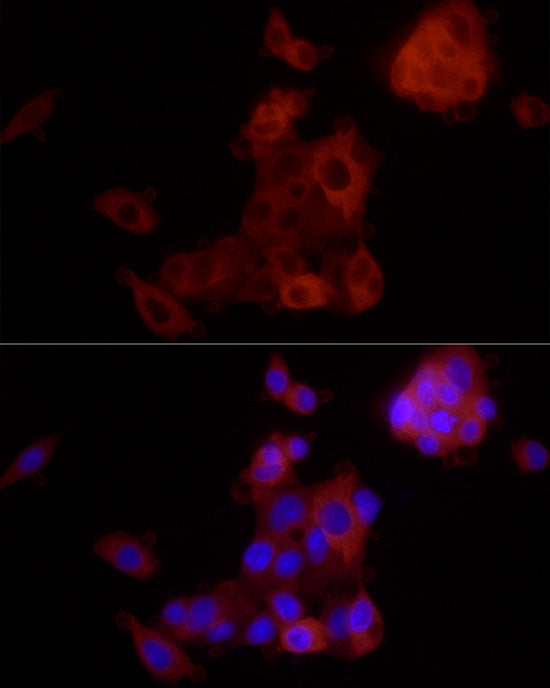 ALDH1A1 Rabbit mAb
