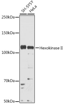 Hexokinase II Rabbit pAb
