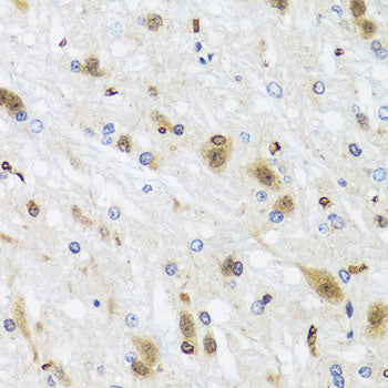 HDAC4 Rabbit pAb