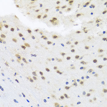 HDAC4 Rabbit pAb
