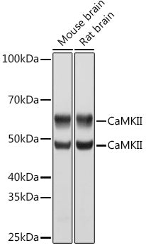 CaMK2 delta/CAMK2 gamma Rabbit mAb