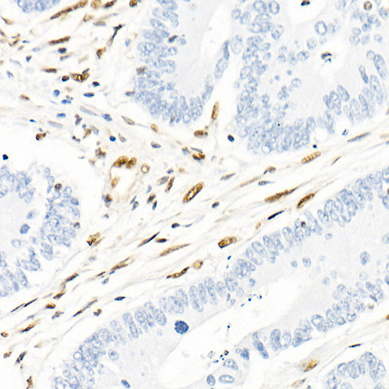 QKI Rabbit mAb