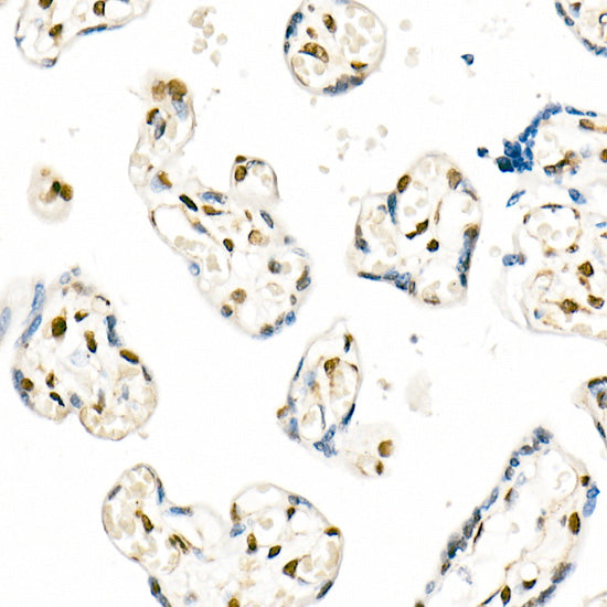QKI Rabbit mAb