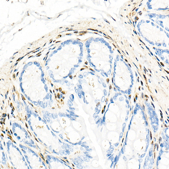 QKI Rabbit mAb
