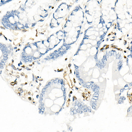 QKI Rabbit mAb