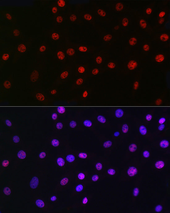 QKI Rabbit mAb