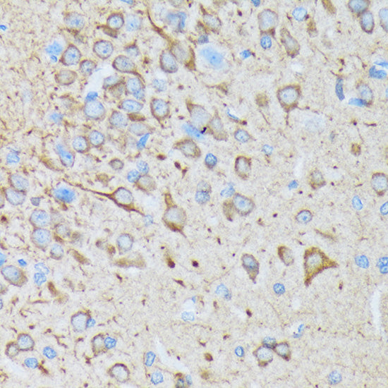 CaMKII Rabbit mAb