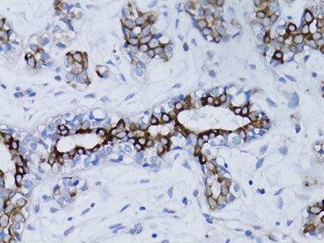 BRCA1 Rabbit pAb