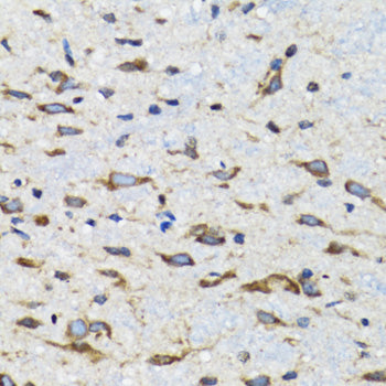 CDK1 Rabbit pAb
