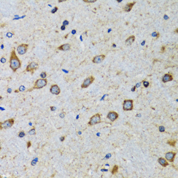 CDK1 Rabbit pAb