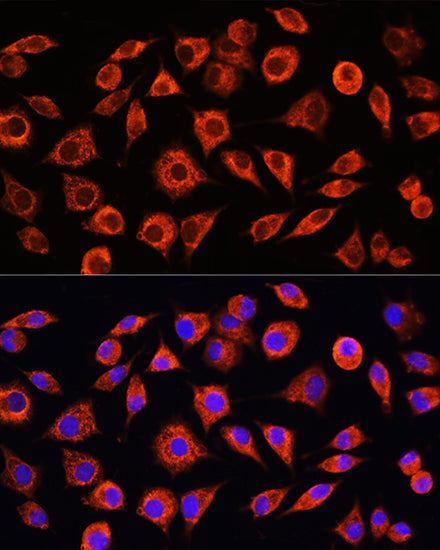 C-Reactive Protein (CRP) Rabbit pAb