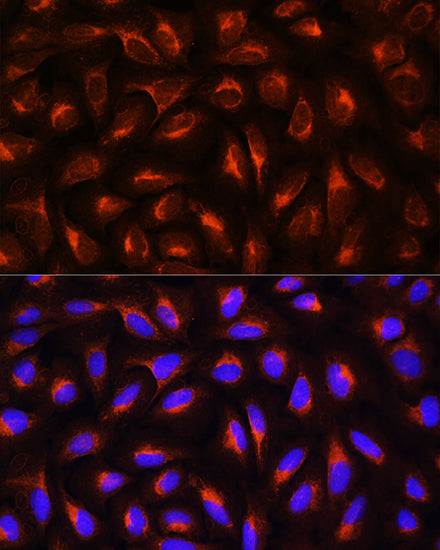 C-Reactive Protein (CRP) Rabbit pAb