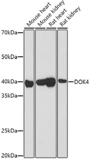 DOK4 Rabbit pAb