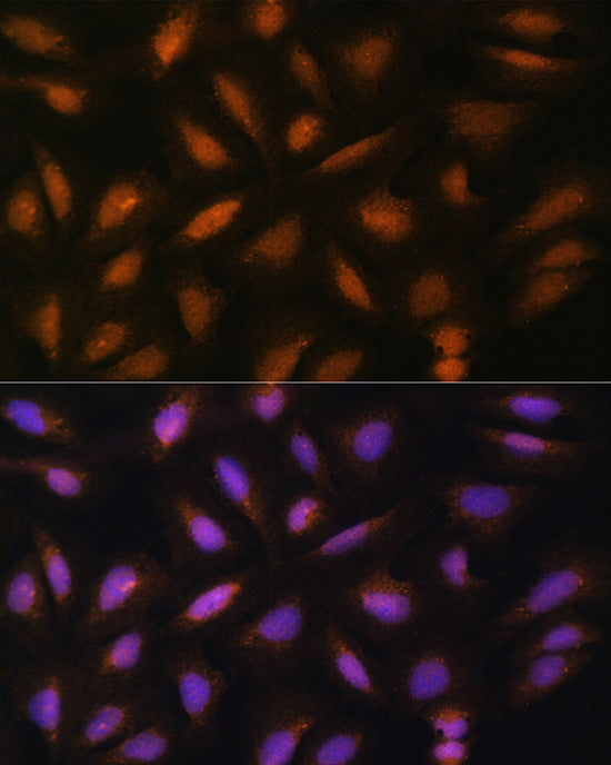 FGF2 Rabbit pAb