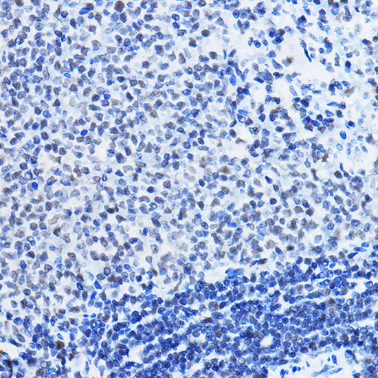 [KD Validated] HDAC1 Rabbit pAb