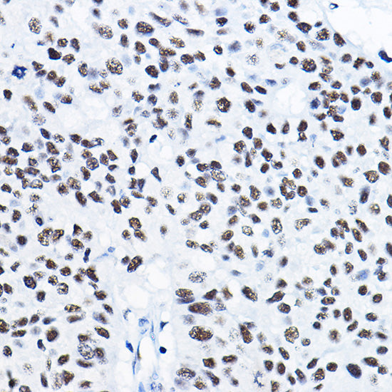 [KD Validated] HDAC1 Rabbit pAb