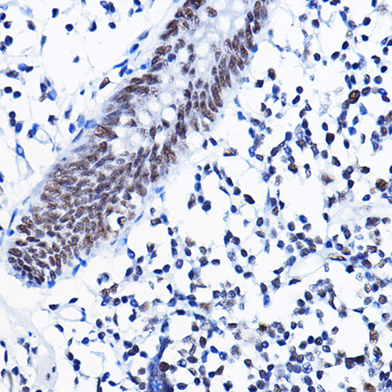 [KD Validated] HDAC1 Rabbit pAb