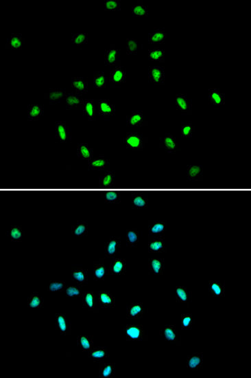 [KD Validated] HDAC1 Rabbit pAb