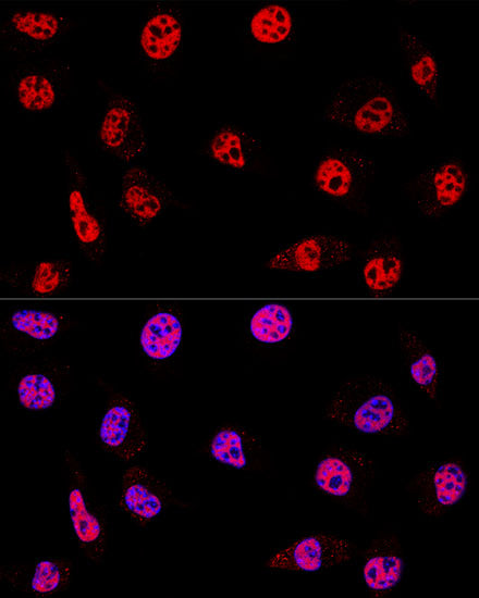 [KD Validated] HDAC1 Rabbit pAb