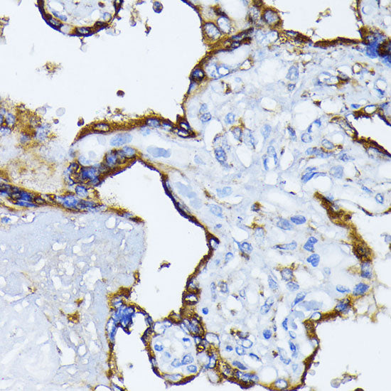 BiP/GRP78 Rabbit pAb