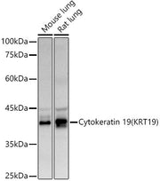 Cytokeratin 19 (KRT19) Rabbit pAb