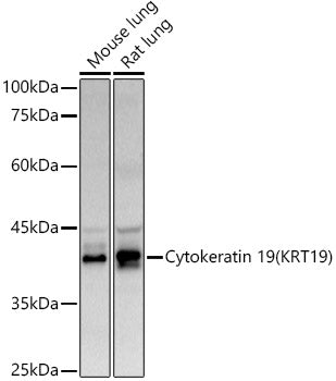 Cytokeratin 19 (KRT19) Rabbit pAb