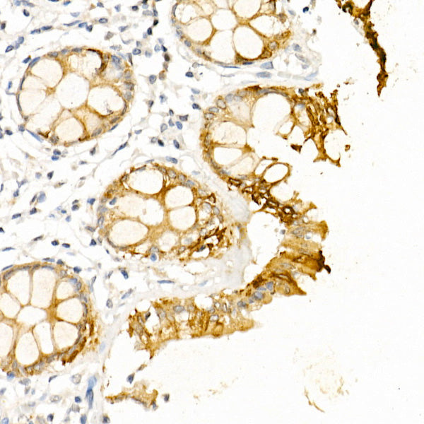 Cytokeratin 19 (KRT19) Rabbit pAb