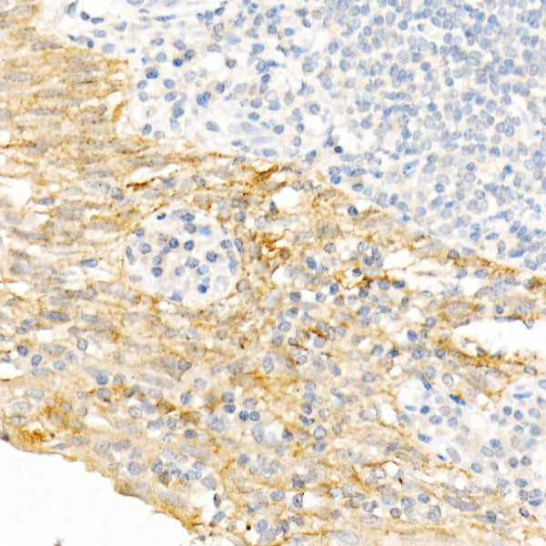 Cytokeratin 19 (KRT19) Rabbit pAb