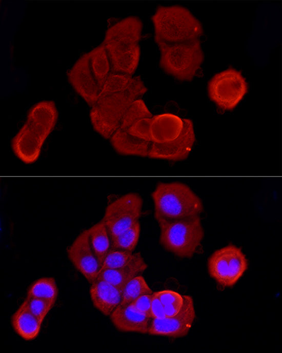 Cytokeratin 19 (KRT19) Rabbit pAb