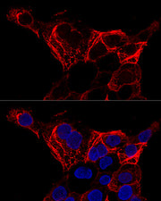 Cytokeratin 20 (KRT20) Rabbit pAb