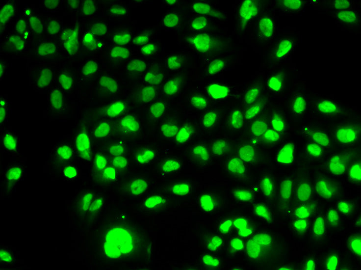 PBEF/Visfatin/NAMPT Rabbit pAb