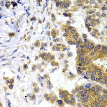 Neurofilament L Rabbit pAb