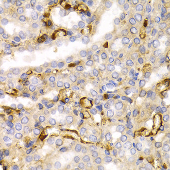 Neurofilament L Rabbit pAb