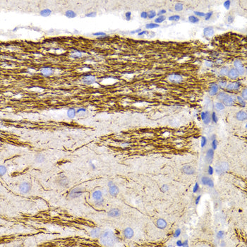 Neurofilament L Rabbit pAb