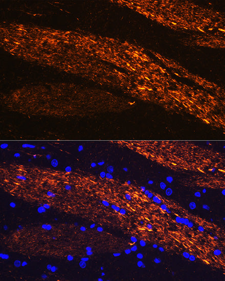 Neurofilament L Rabbit pAb