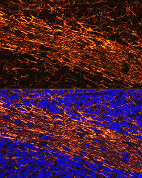 Neurofilament L Rabbit pAb