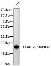 [KO Validated] CDKN2A/p16INK4a Rabbit pAb