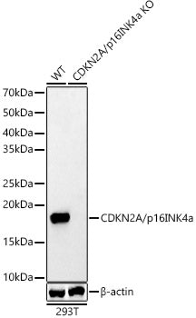 [KO Validated] CDKN2A/p16INK4a Rabbit pAb