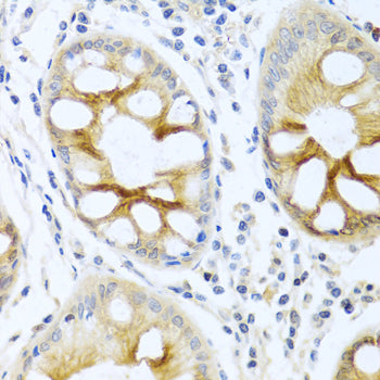 PKC alpha Rabbit pAb