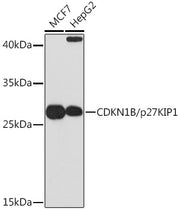 CDKN1B/p27KIP1 Rabbit pAb