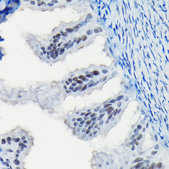 Progesterone Receptor Rabbit pAb