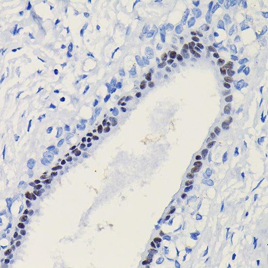 Progesterone Receptor Rabbit pAb