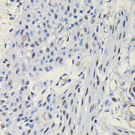 Progesterone Receptor Rabbit pAb