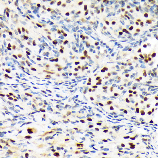 PBRM1 Rabbit mAb