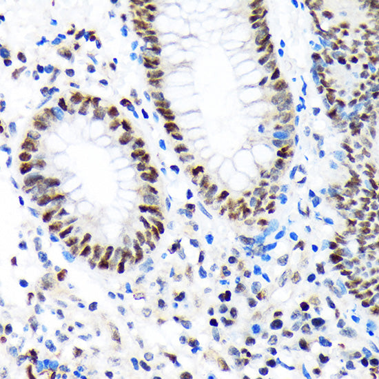 PBRM1 Rabbit mAb